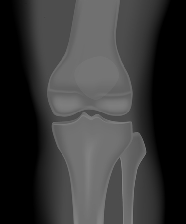 Functional Progression and Milestones
