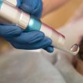 Rehabilitation of Swallowing Function after Stroke: American Clinical Practices