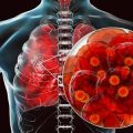 Understanding the Role of Breathing Exercises in Cardiac and Pulmonary Rehabilitation: Evidence, Benefits, and Limitations