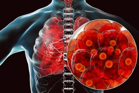 Understanding the Role of Breathing Exercises in Cardiac and Pulmonary Rehabilitation: Evidence, Benefits, and Limitations