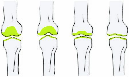 Essential Exercises and Techniques Used in Physical Therapy