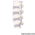 Comparing Electrical Stimulation Therapy Devices: Features, Efficacy, and Best Practices in the US