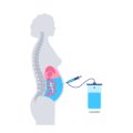 Adapting Rehabilitation Protocols for Older Adults with Spinal Conditions