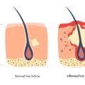 Comparing Non-Surgical and Surgical Interventions in Rotator Cuff Repair