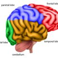 Navigating Educational Systems and IEPs for Students with Cerebral Palsy in the United States