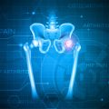 Research Trends and Innovations in Voice Therapy for Vocal Cord Disorders