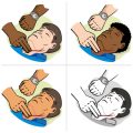 Cultural Sensitivity and Communication: Promoting Electrical Stimulation Therapy in Diverse US Communities
