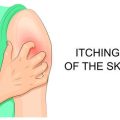 Understanding the Stages of Bone Healing in Americans: What Every Patient Should Know